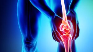 Osteoartritis artrosis