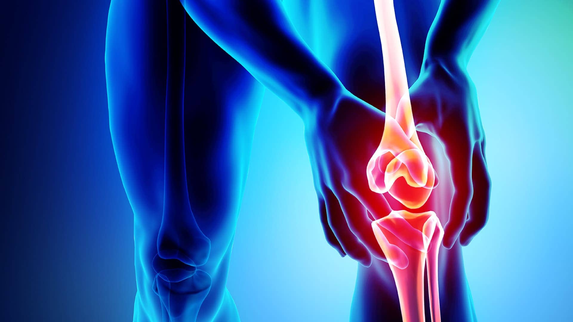 Osteoartritis artrosis